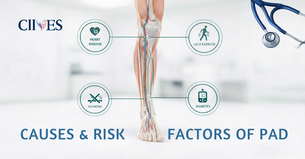 Causes & Risk Factors of PAD