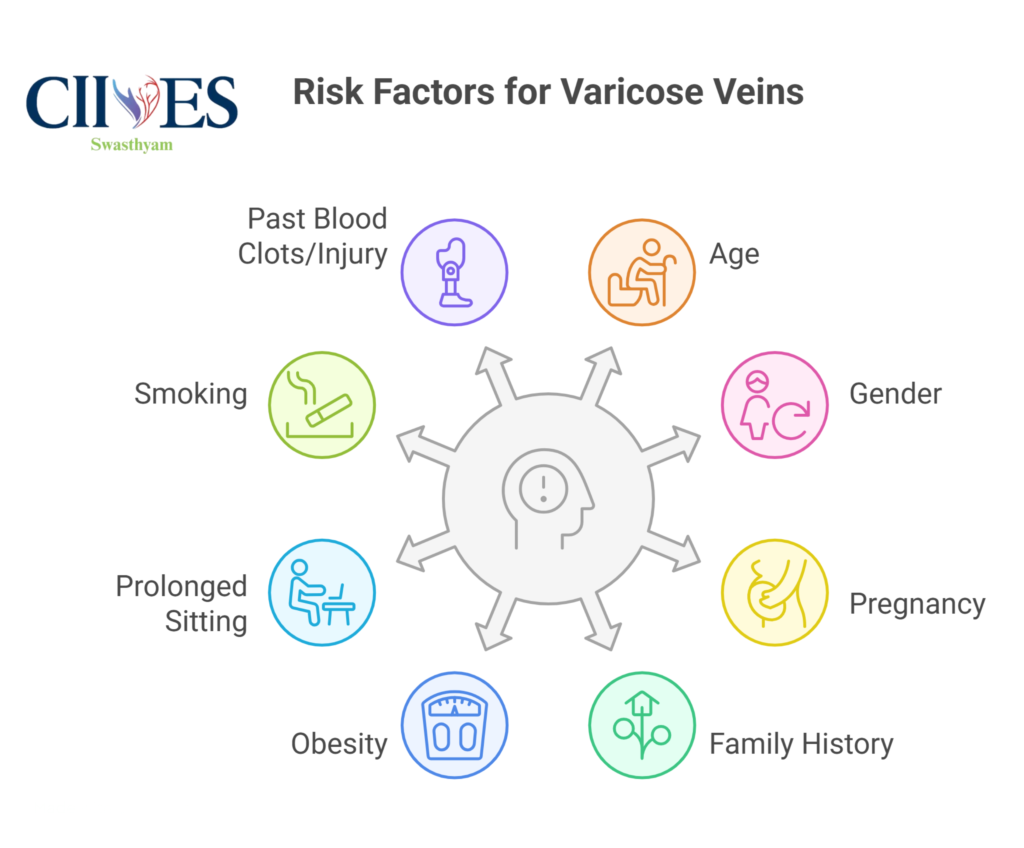Risk factors causing varicose veins in legs