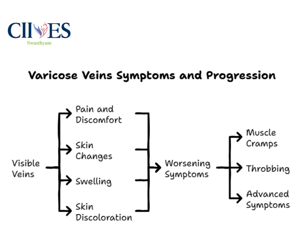 what is varicose veins