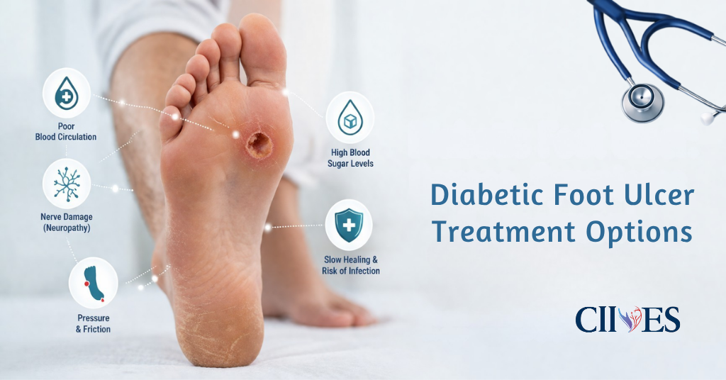 Diabetic Foot Ulcer Treatment Options