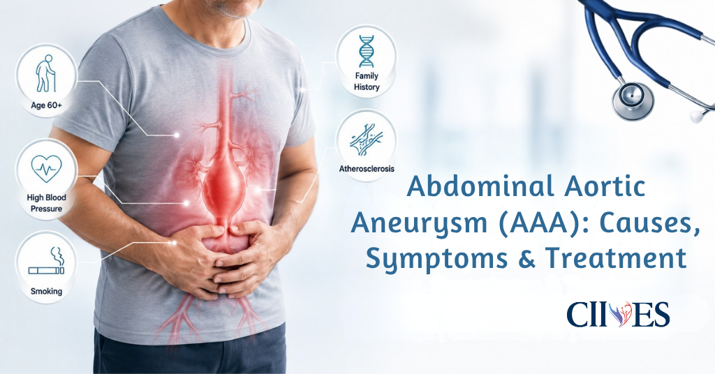Abdominal Aortic Aneurysm (AAA): Causes, Symptoms & Treatment