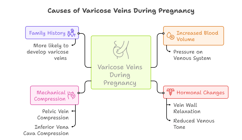 Causes of Varicose Veins in Pregnancy