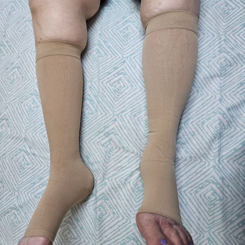 Compression stockings support the veins and prevent blood pooling.