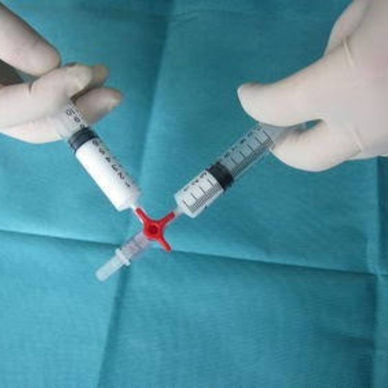 Medical foam is injected to close smaller varicose or spider veins