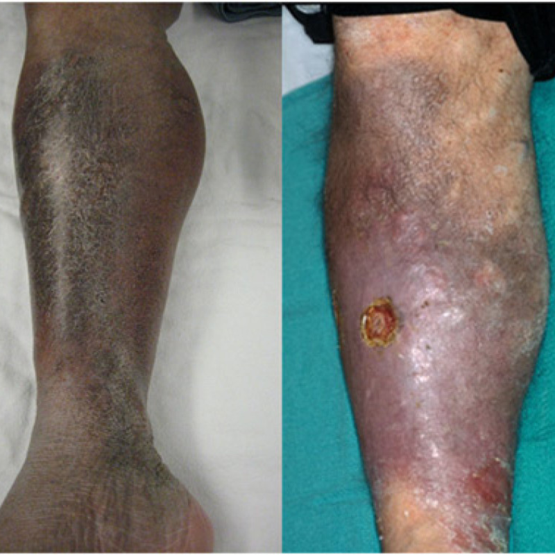 Skin becomes dark & discoloured