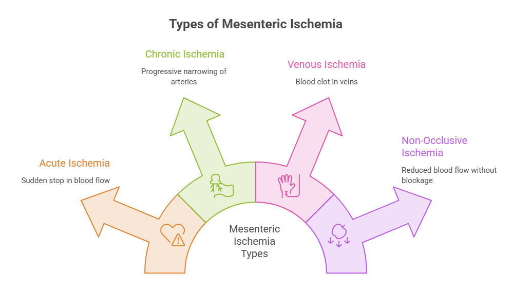 Types of bowel ischemia or mesenteric ischemia